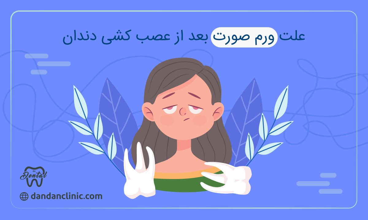 علت ورم صورت بعد از عصب‌کشی دندان